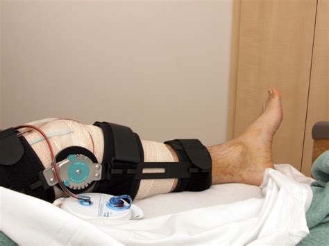 Overcome Pain and Regain Mobility: Steps to Successful ACL Repair Surgery